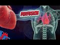 Myocardial perfusion imaging - Human Heart ❤️ and Cardiology ❤️🔊✅