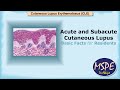 Skin: Acute & Subacute Cutaneous Lupus (Basic Facts for Residents)