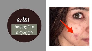 რა არის აკნე?|GKF|Kartuli|Georgia|Videos|Health tips|Acne