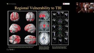 BIBH Webinar 4: Improving Cognitive Outcomes After Traumatic Brain Injury