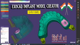 How To Design a Digital Implant Model In Exocad  || implant Model Creator Exocad 🦷