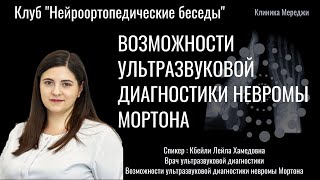 Нейроортопедические беседы. Неврома Мортона.