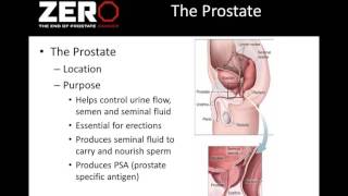 Webinar: Prostate Cancer and Bone Health