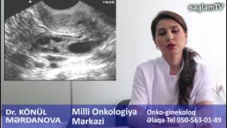 Dr. Könül Merdanova. Onko-ginekoloq müayinesi nece olur? Hansı müayineler aparılır?