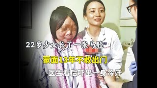 22歲少女長了一張馬臉，蒙面13年不敢出門，醫生看后嚇出一身冷汗