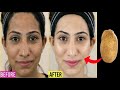 Japanese secret 🌹for skin whitening, also remove pigmentation and melasma fast!!!