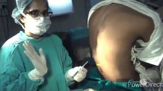 Epidural Live Technique