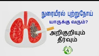 நுரையீரல் புற்றுநோய் யாருக்கெல்லாம் வரும்? அறிகுறியும் தீர்வும்