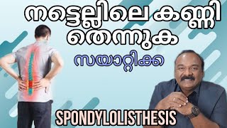 നട്ടെല്ലിൽ ഡിസ്ക് ആണോ കണ്ണിയാണോ തെന്നുക. | സയാറ്റിക്ക | Spondylolisthesis