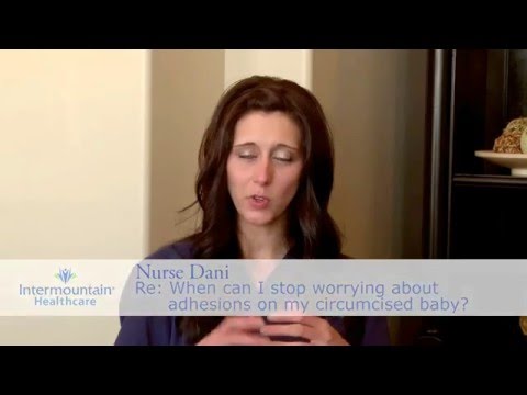 When can I stop worrying about adhesions on my circumcised baby? When can I stop worrying about adhesions on my circumcised baby?