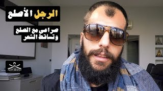 Episode 42 - الرجل الأصلع - صراعي مع الصلع - The Man Brand Lifestyle