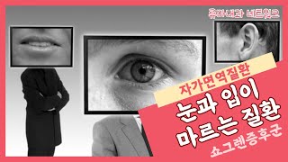 눈과 입이 마르는 질환 쇼그렌증후군? [류마내과]