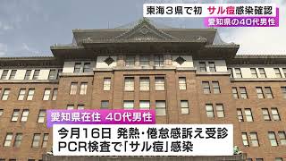 海外渡航歴なく感染経路不明…『サル痘』感染者を東海3県で初確認 愛知の40代男性で発熱や倦怠感等訴える