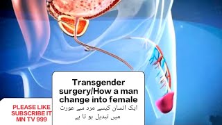#How a man change into female #transgendersurgery2022 #transgender surgery effect #MNTV999