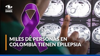 Día mundial de la epilepsia: ¿qué tan común es esta condición?