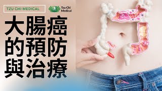 如何早期發現大腸癌？大腸癌有哪些症状？大腸癌不上身的飲食生活習慣 l 慈濟醫療 l 慈濟健康講座