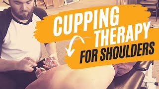 Cupping Therapy Techniques for the Shoulder