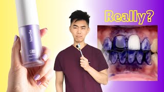 DENTIST explains if HiSmile V34 Whitening Serum actually works