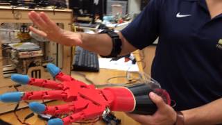 3D Prosthetic Hand