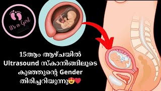 Ultrasound സ്കാനിങ്ങിൽ കുഞ്ഞ് ഏതാണെന്ന് തിരിച്ചറിയുന്നത് കാണാം😍 | Fetal Gender On ultrasound.