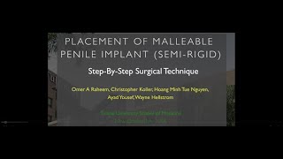 Surgical video for malleable penile implant penoscrotal approach