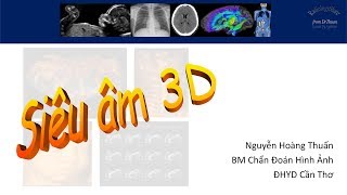 Siêu âm 3D phần 1