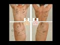 Quadrants of chest #shortsfeed #doctor #short #shortsvideo