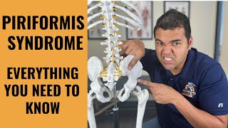 Piriformis Syndrome   Everything You Absolutely Need To Know To Get Better