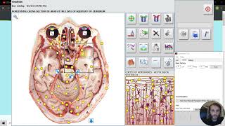 Brain White Matter and Gray matter scan and Meta therapy on meta hunter 4025