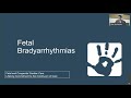 fetal arrhythmias and treatment