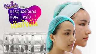 2 คำถามหมอหนึ่งตอบได้ EP15 : การดูแลตัวเอง ก่อน - หลังการเติมไขมันหน้า::: [Siam Loft Clinic]