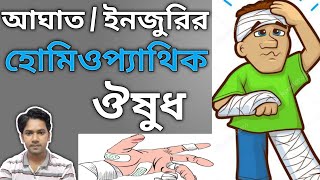 আঘাত বা ইনজুরির হোমিওপ্যাথি ওষুধ | চোট আঘাতের জন্য হোমিও ওষুধ |