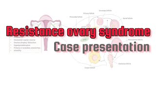 Resistance ovary syndrome |Case presentation #PharmD_cases