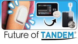 Tandem's Future: A Tubeless Pump, Mobi \u0026 Dexcom G7 Integration