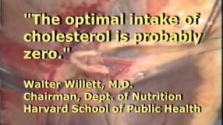 Open Heart Surgery - pulling cholesteral fat fungi fiber from artery