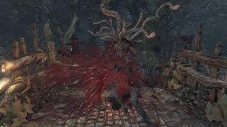 -PART11- 俺、ちょっと狩人になってくる。【Bloodborne】