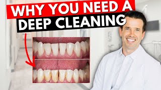 Prophy vs. Deep Cleaning...What's the difference? | Healthy Mouth Dental Cleaning vs. SRP