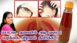 சொட்டை தலையில் முடி வளர! வழுக்கை விழாமல் தவிர்க்க!|| Hair Oil For Bald Head|| KAI PAKKUVAM