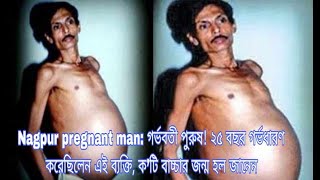 Nagpur pregnant man: গর্ভবতী পুরুষ! ২৫ বছর গর্ভধারণ করেছিলেন এই ব্যক্তি, ক’টি বাচ্চার জন্ম হল জানেন?