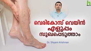 വെരികോസ് വെയിൻ കാരണങ്ങളും ചികിത്സയും | Varicose veins Malayalam Health Tips | Arogyam