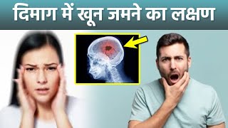 Brain Blood Clot Symptoms In Hindi: Severe Headache To Blurred Vision | Boldsky