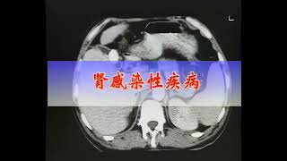 【高清重制】卫生部医学视听教材-影像学-CT006 泌尿、男性生殖系统的CT、MRI诊断