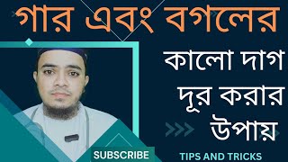 গার এবং বগলের নিচে কেন কালো দাগ হয়ে থাকে এই কালো দাগ দূর করার কার্যকরী উপায়