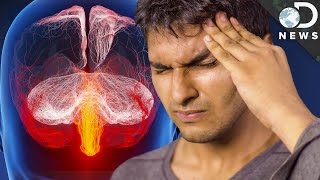 Why Do We Get Migraines?