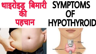 Symptoms of hypothyroidism | थाइरोइड बीमारी के लक्षण । हाइपोथाइरोइड की पहचान । Hypothyroidism |