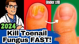 #1 NEW Best Toenail Fungus Treatments [Medications vs Creams vs Laser]