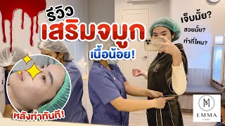 รีวิวจมูกเนื้อน้อยก็โด่งได้ เล่าลายละเอียดเสริมครั้งแรก| AMARI A