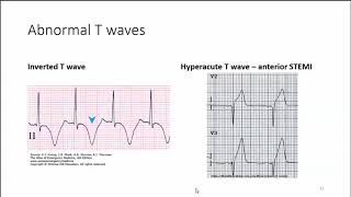 Cardiac Compromise