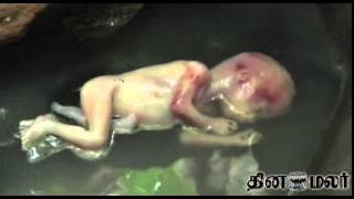 5 Months Old Baby Thrown in Trichy - Dinamalar June 5th 2015 Tamil Video News