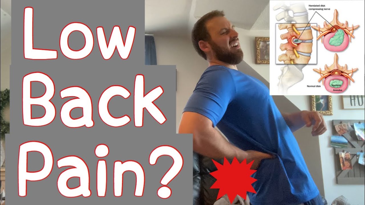 Treat Low Back Pain With Core Strengthening - YouTube